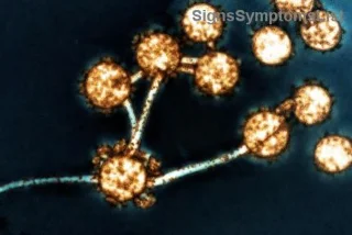 Can Advanced Ovarian Cancer (Stage 3 & 4) Be Cured? Hopeful Insights and Treatment Paths