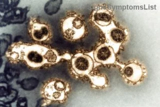 Is Chronic Lymphocytic Leukemia (CLL) Curable? Hopeful Insights and Effective Solutions