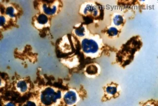大腸がん手術後の食事革命：高繊維食品で健康を取り戻せ！避けるべき食材も徹底解説