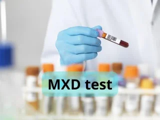 O que é MXD no exame de sangue? Entenda o significado deste indicador