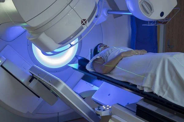 Enteritis radiasi: catatan selama perawatan!