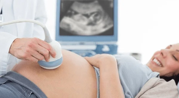 Tali pusat arteri tunggal: definisi, etiologi, prognosis?