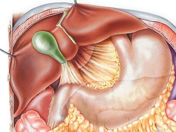 Apakah Refluks Empedu Refluks Gastroesofageal?