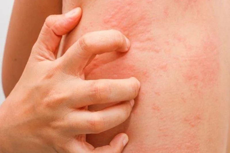 Precauciones para el anticoagulante Pradaxa (dabigatrán)
