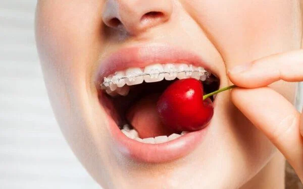 Что едят люди с брекетами и что им нельзя?