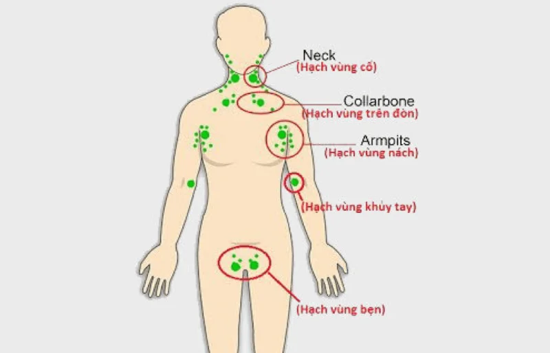 Wat zijn de symptomen van gezwollen lymfeklieren in de vagina van een vrouw?