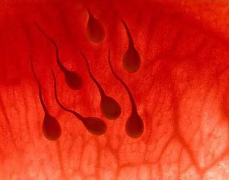 Is geel sperma normaal?