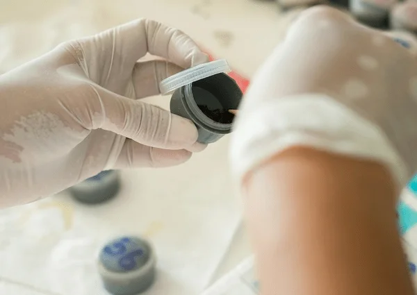 Опасен ли Blastocystis hominis?