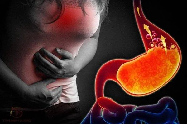 Tali pusat arteri tunggal: definisi, etiologi, prognosis?